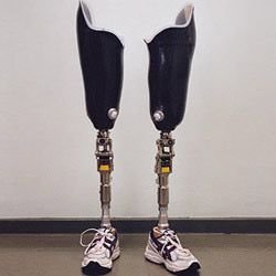 Knee Prosthesis